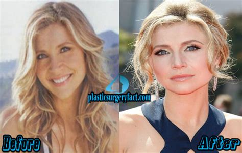 sarah chalke plastic surgery|Sarah Chalke Archives .